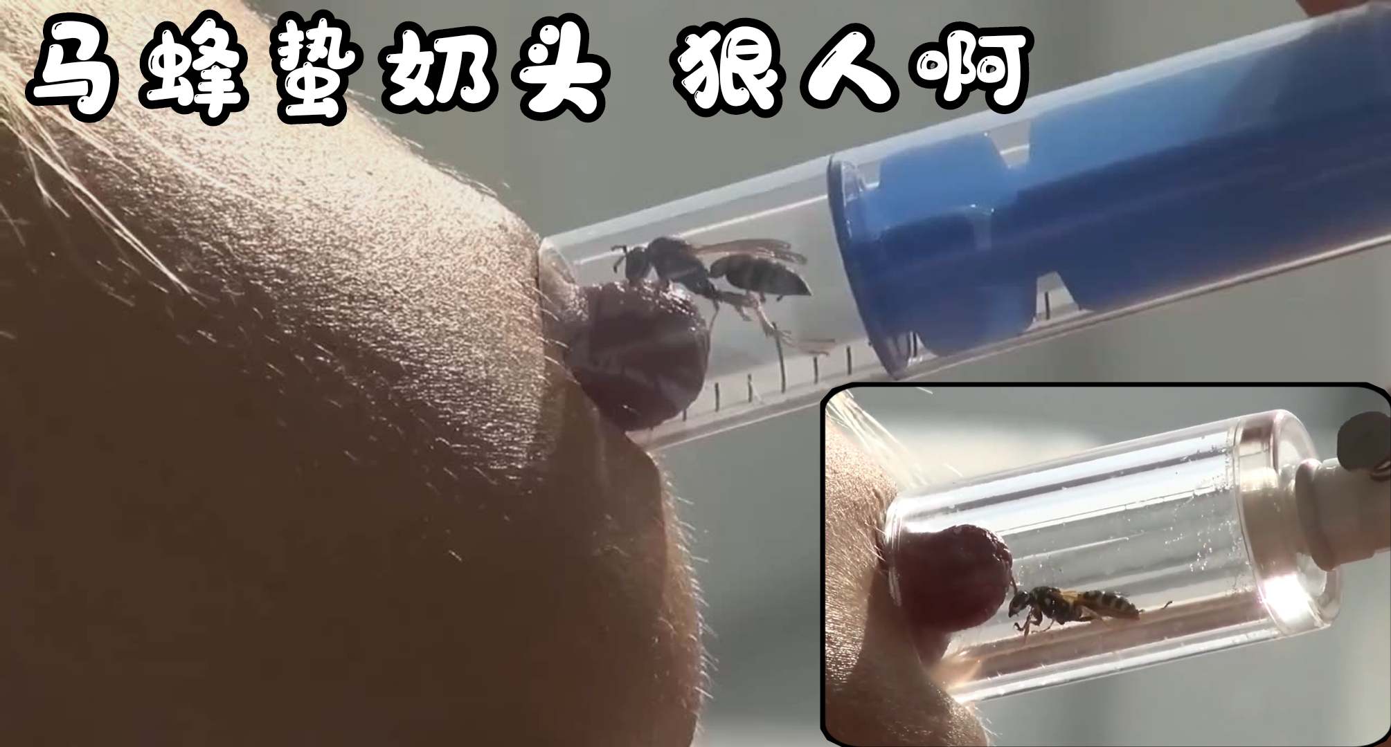 马蜂蛰奶头狠人啊 的封面
