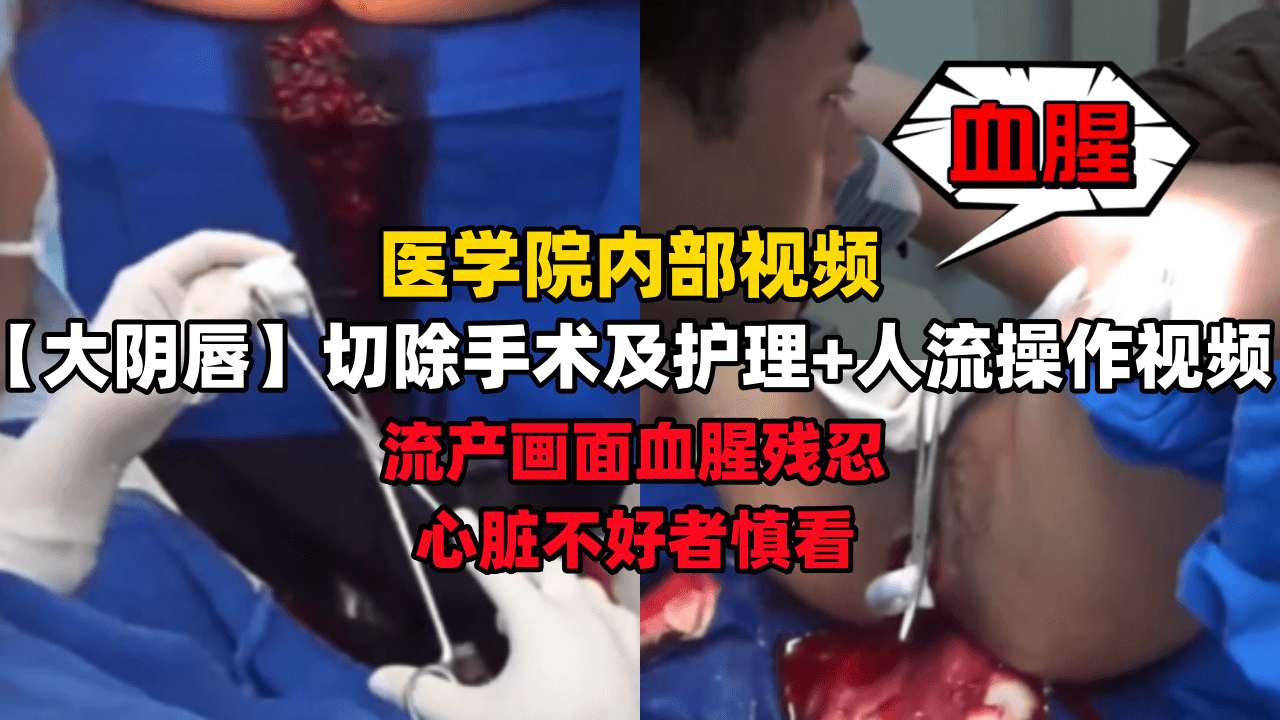 【绝密医院内部视频】大阴唇切除手术及护理+人流操作视频，流产画面血腥残忍，心脏不好者慎看！ のポスター