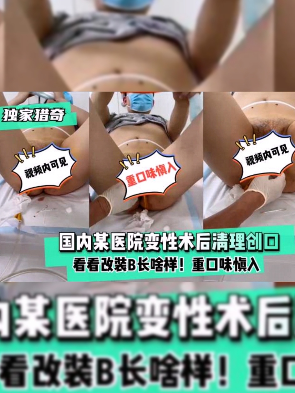 【独家猎奇】国内某医院变性术后清理创口 포스터