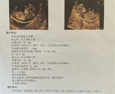 分享一下自己当妓时的感受
