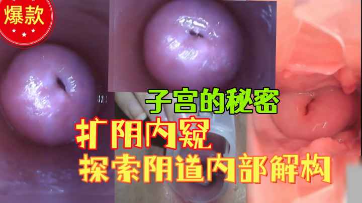 {扩阴内窥子宫}了解阴道内部解构,子宫清晰可见,稀缺资源! 포스터