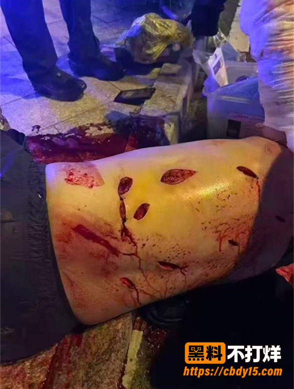 福建石狮八卦街醉汉驾车撞人后行凶 3